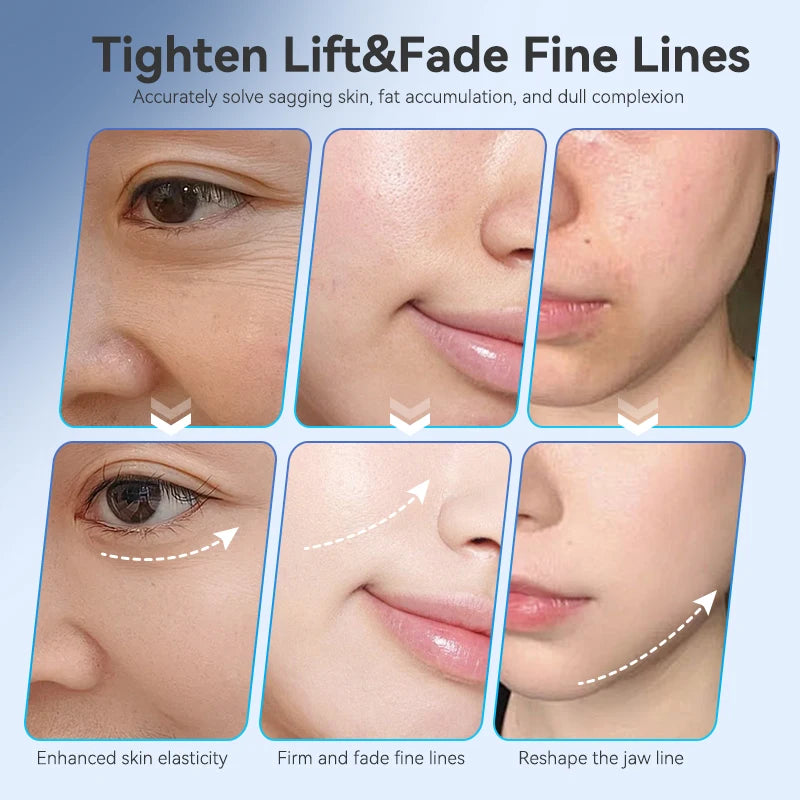 Facial Sculpt Device