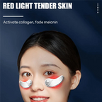 Eye Therapy Device