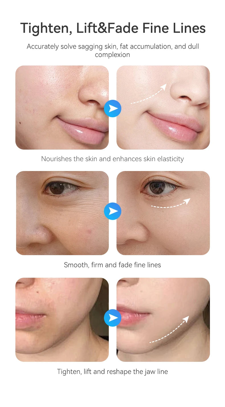 Facial Sculpt Device